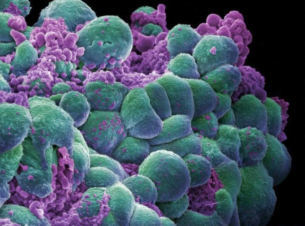 乳腺癌细胞系